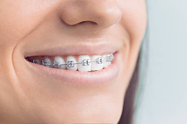 Best Sedation Dentistry  in Osceola, MO
